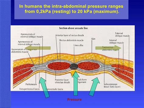 Ventral Hernia Challenges And Choices