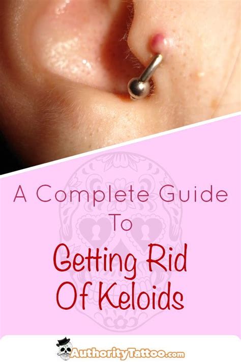 Everything You Need To Know About Getting Rid Of Keloids Around Your Piercings Keloid Piercing