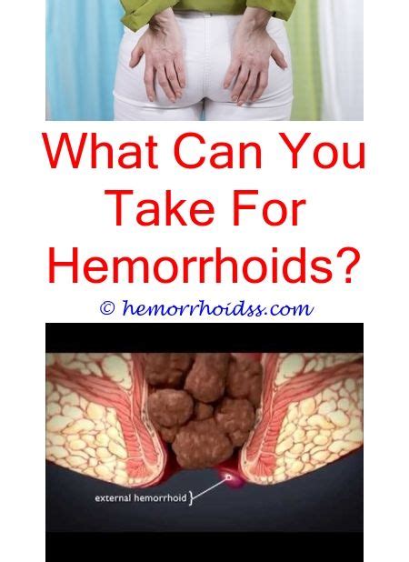 How To Stop Itching Internal Hemorrhoids Can Hemorrhoids Cause Narrow