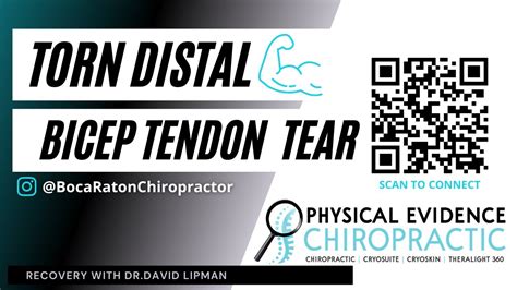 Torn Distal Bicep Tendon Tear Recovery Youtube