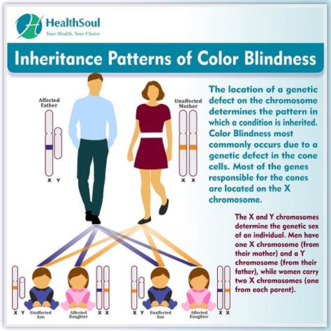 Color Blindness Symptom Diagnose And Treatment Healthsoul Free Hot