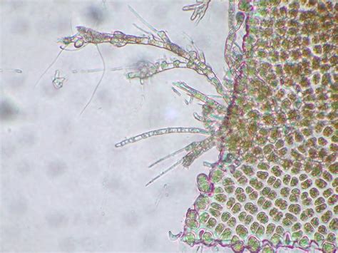 Porphyra Microscope