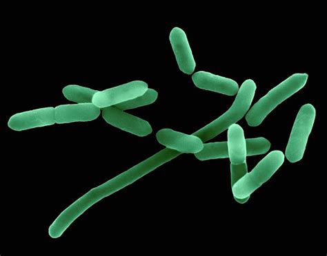 Listeriosis symptoms and signs include diarrhea, nausea, and fever. Listeria Monocytogenes Photograph by Dennis Kunkel ...