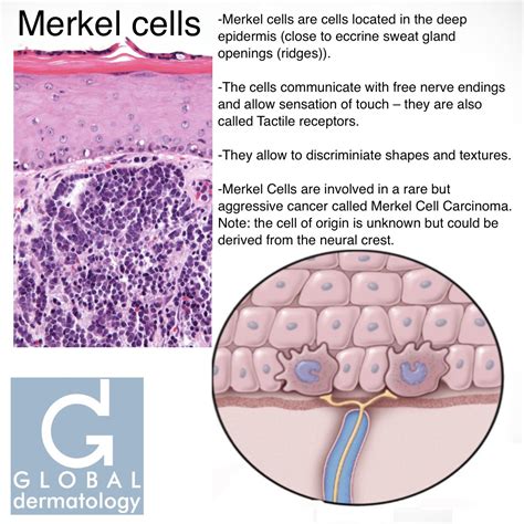 Global Dermatology Merkel Cell Instagram