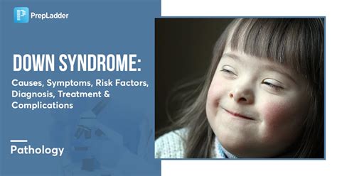 Down Syndrome Causes Symptoms Risk Factors Diagnosis Treatment And