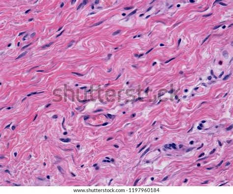 Reticular Dermis Dense Irregular Connective Tissue Foto Stok 1197960184