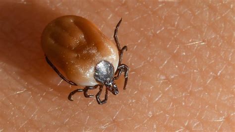Tick Bite Treatment A Complete Guidelines Live Enhanced