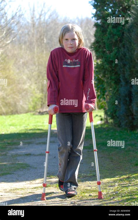 Girl Walking On Crutches Stockfoto Lizenzfreies Bild
