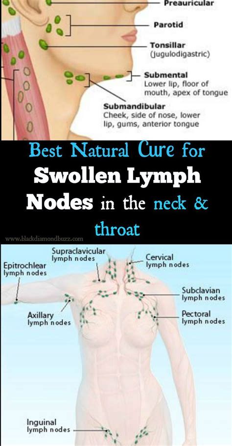 Best Essential Oils For Swollen Glands Swollen Lymph Nodes Essential