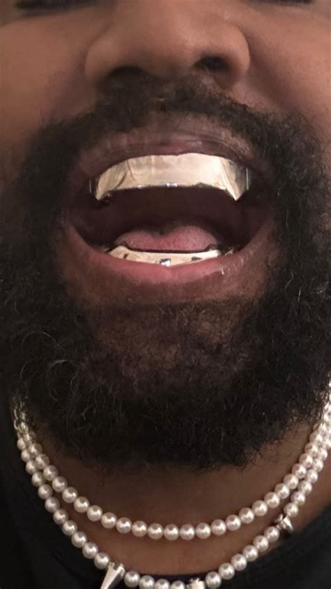 Kanye West Shows Off New Jaws Inspired Teeth After Getting £670000