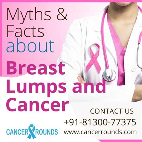 Myths And Facts About Breast Cancer Treatment