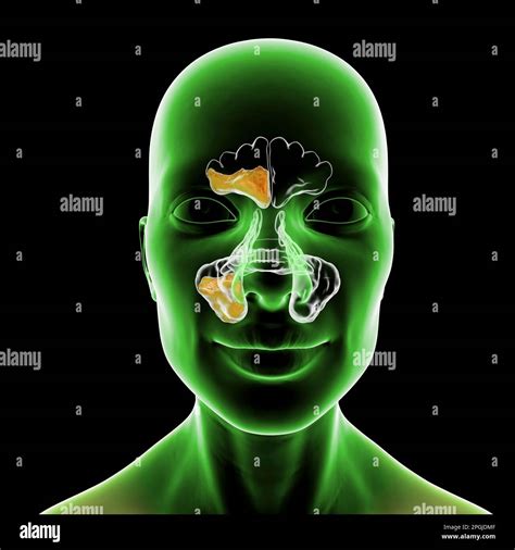 Inflamed Sinuses Hi Res Stock Photography And Images Alamy