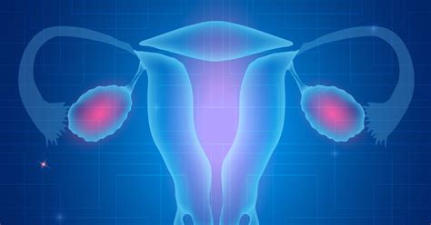 Study Fallopian Tube Lesions An Early Sign Of Ovarian Cancer Ctca