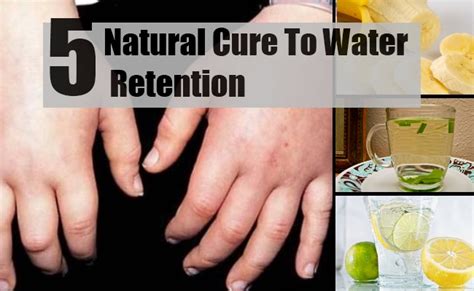 5 Natural Cure For Water Retention How To Cure Water Retention