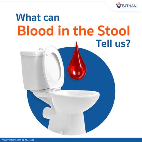 Great Blood In Stool Remedy In The World Learn More Here Stoolz