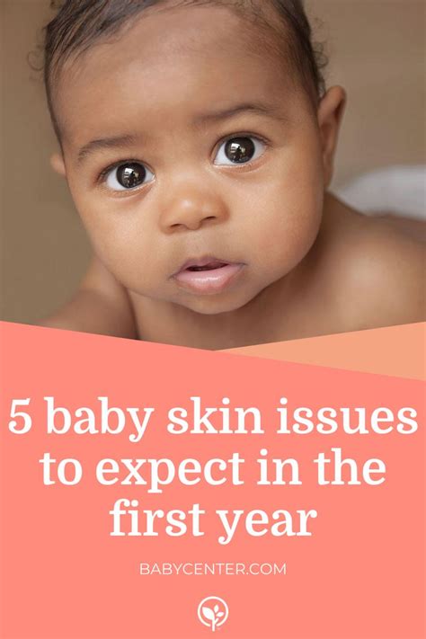 5 Baby Skin Issues To Expect In The First Year Babycenter In 2021