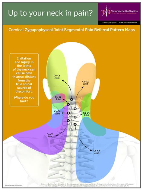 Neck Pain Sclerotome Chiropractic Biophysics