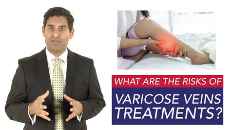 What Are The Risks Of Varicose Veins Treatment Youtube