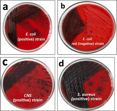 Biofilm Forming Bacteria On Congo Red Agar Plate Clarified That E Coli