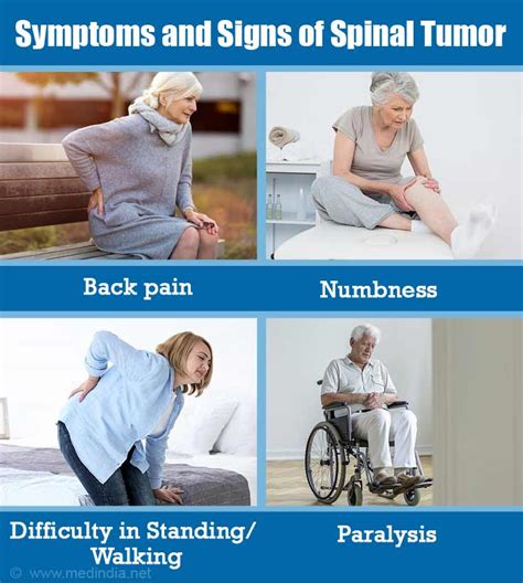 Spinal Cancer Symptoms And Signs Cancerwalls