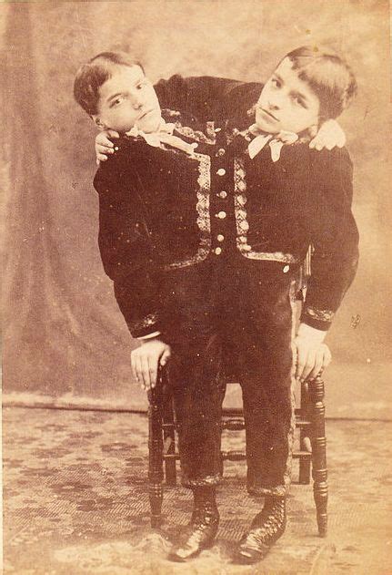 7 Most Incredible Siamese Twins In History Conjoined Twins Human Oddities Vintage Circus Photos