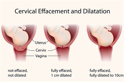 Things You Didnt Know About Labor Cervix Dilation Cervical