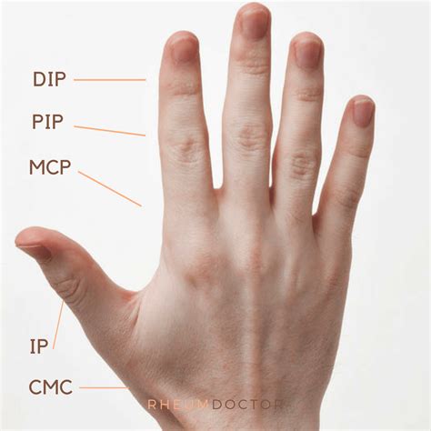 Hand Anatomy 2 Rheumdoctor