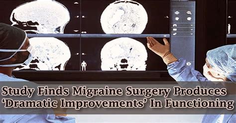 Study Finds Migraine Surgery Produces ‘dramatic Improvements In