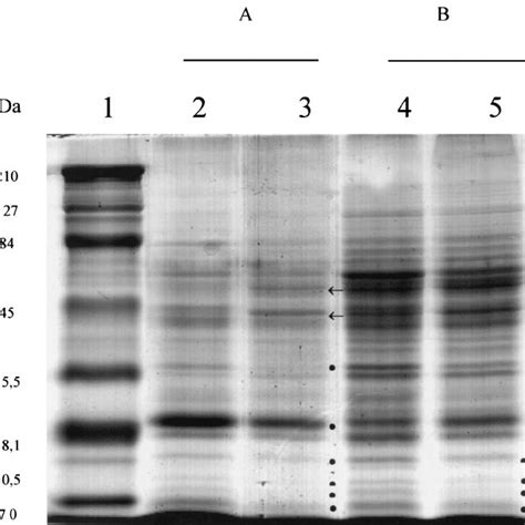 Protein Pro Fi Les Of Strains Cdc E8392 A And 241 B Of C