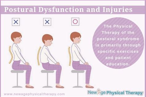 Postural Dysfunction And Injuries The Physical Therapy Of The Postural Syndrome Is Primarily