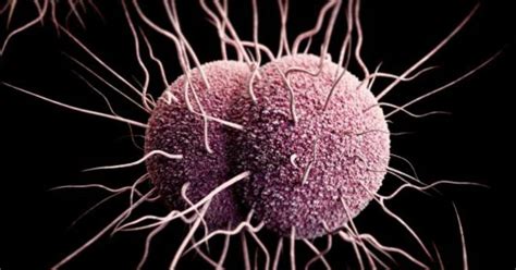 First Case Of Super Resistant Gonorrhea Reported Cbs Philadelphia