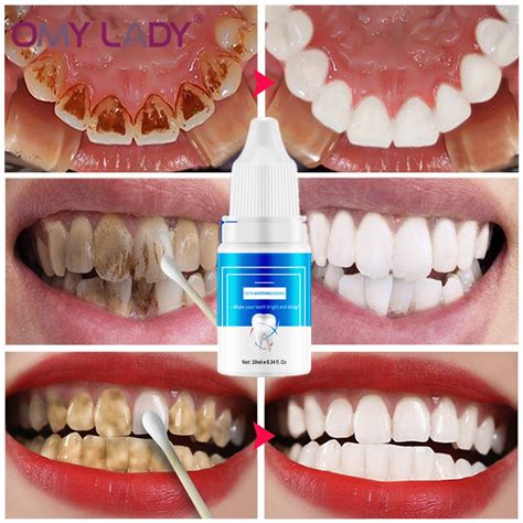 Omylady Teeth Whitening Tooth Brush Essence Oral Hygiene Cleaning Serum