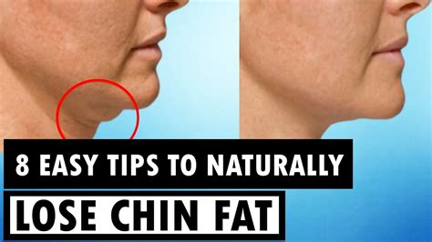 How To Lose Chin Fat Youtube