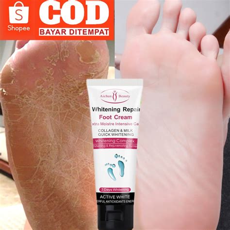 Jual Obat Kaki Pecah Dan Kering Tumitku Obat Kaki Pecah 30g Penghalus