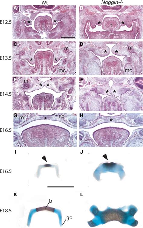 Palate And Hyoid Bone Development In Noggin 22 Mice A H