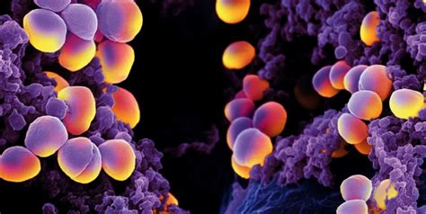 Bakteri Staphylococcus Aureus Mempunyai Bentuk Homecare