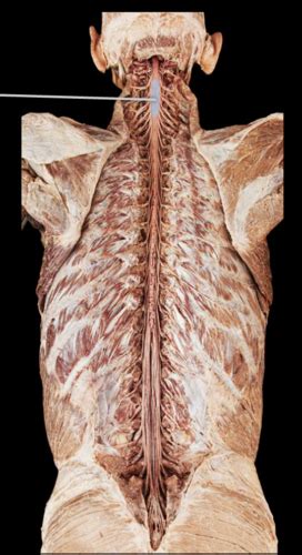 Cadaver Pictures Anatomy Anatomy Diagram Source