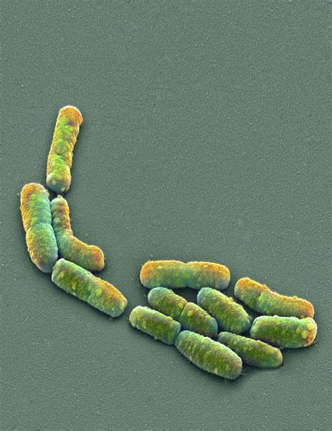 E Coli Bacteria Sem Photograph By Steve Gschmeissner Fine Art America
