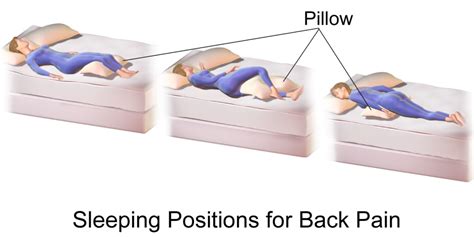 The Best Sleeping Positions For Back Pain
