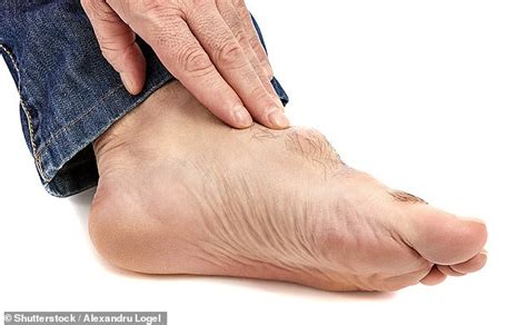 Is My Numb Big Toe A Sign Of Something Sinister Dr Martin Scurr