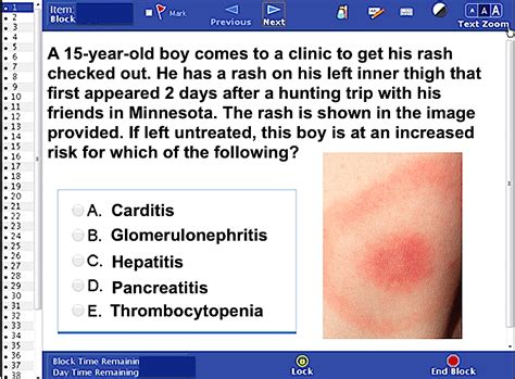 Can You Answer This Usmle Questionanswer At