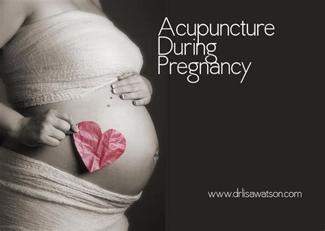 Acupuncture During Pregnancy Page 001 Dr Lisa Watson
