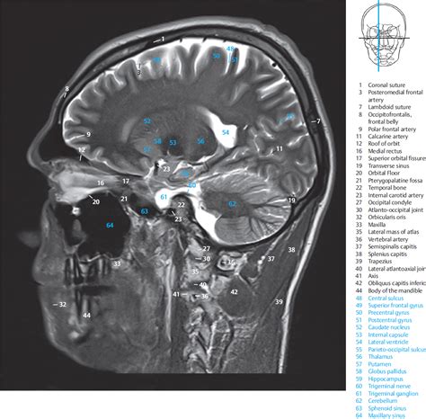 4 Sagittal Sections Radiology Key