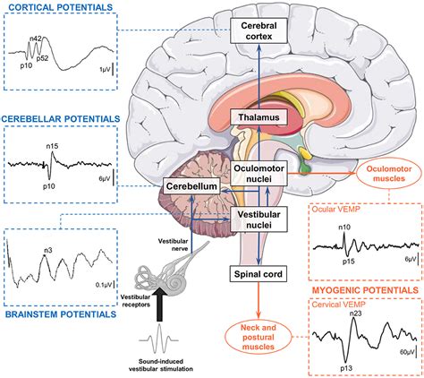 Frontiers Vestibular Evoked Cerebral Potentials