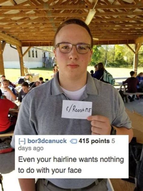 Funniest hairline roasts (jokes) for people with receding. Selection Of Roasts (32 pics)