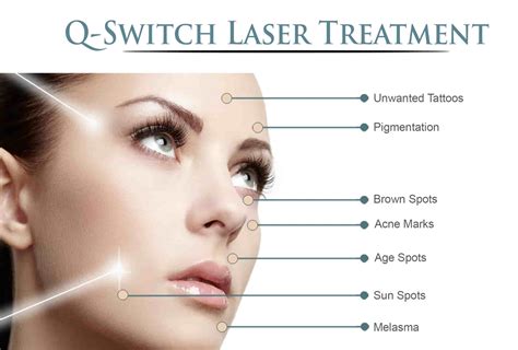 Q Switched Laser Vernon Skin And Hair Clinic