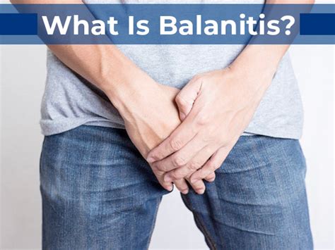 Balanitis Types Causes Symptoms Diagnosis Complications Treatment