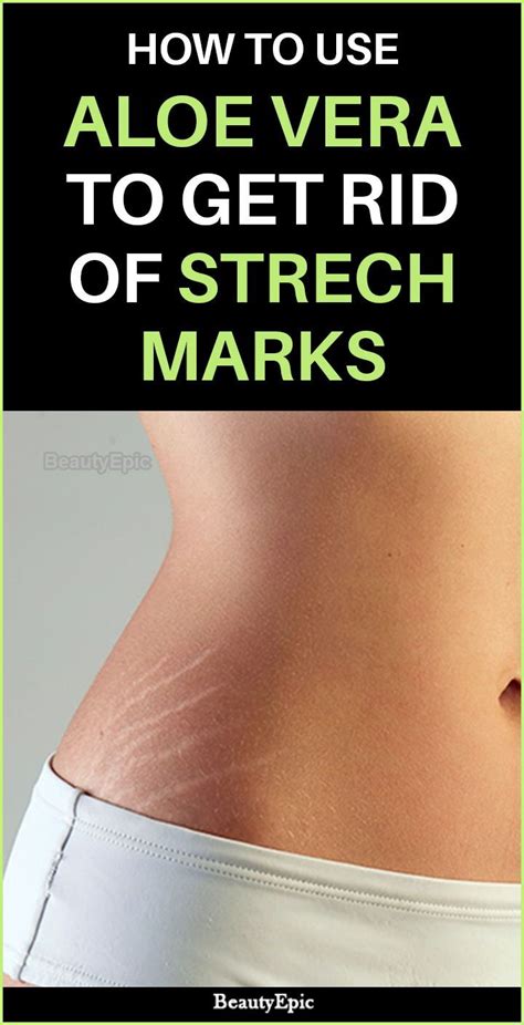 how to use aloe vera to get rid of stretch marks fast stretch marks stretch mark remedies
