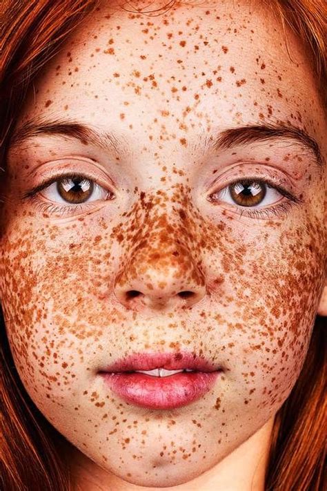 Freckles Photographer Shines Spotlight On The Beauty Of Spots Today