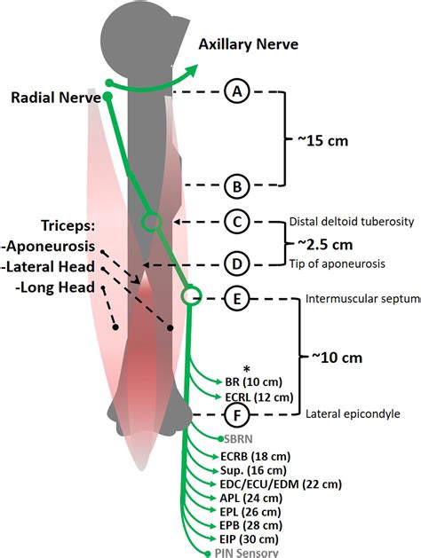 Radial Nerve Injury In Humeral Shaft Fracture Orthopedic Clinics
